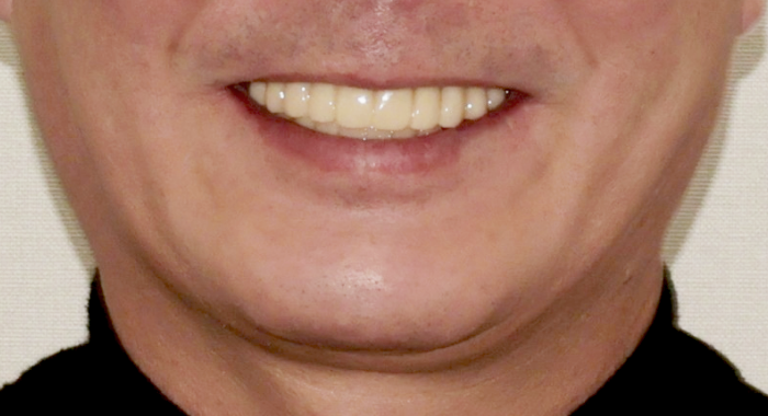 After